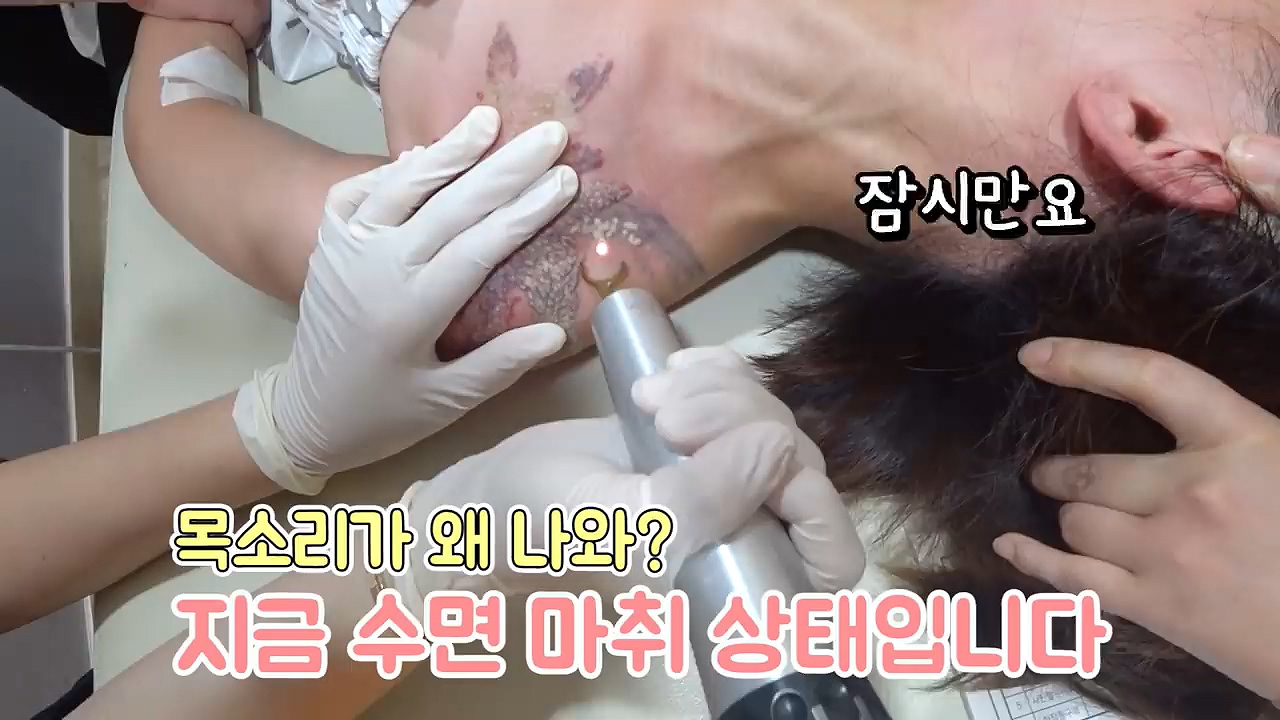 문신 제거 후기 - 꾸르