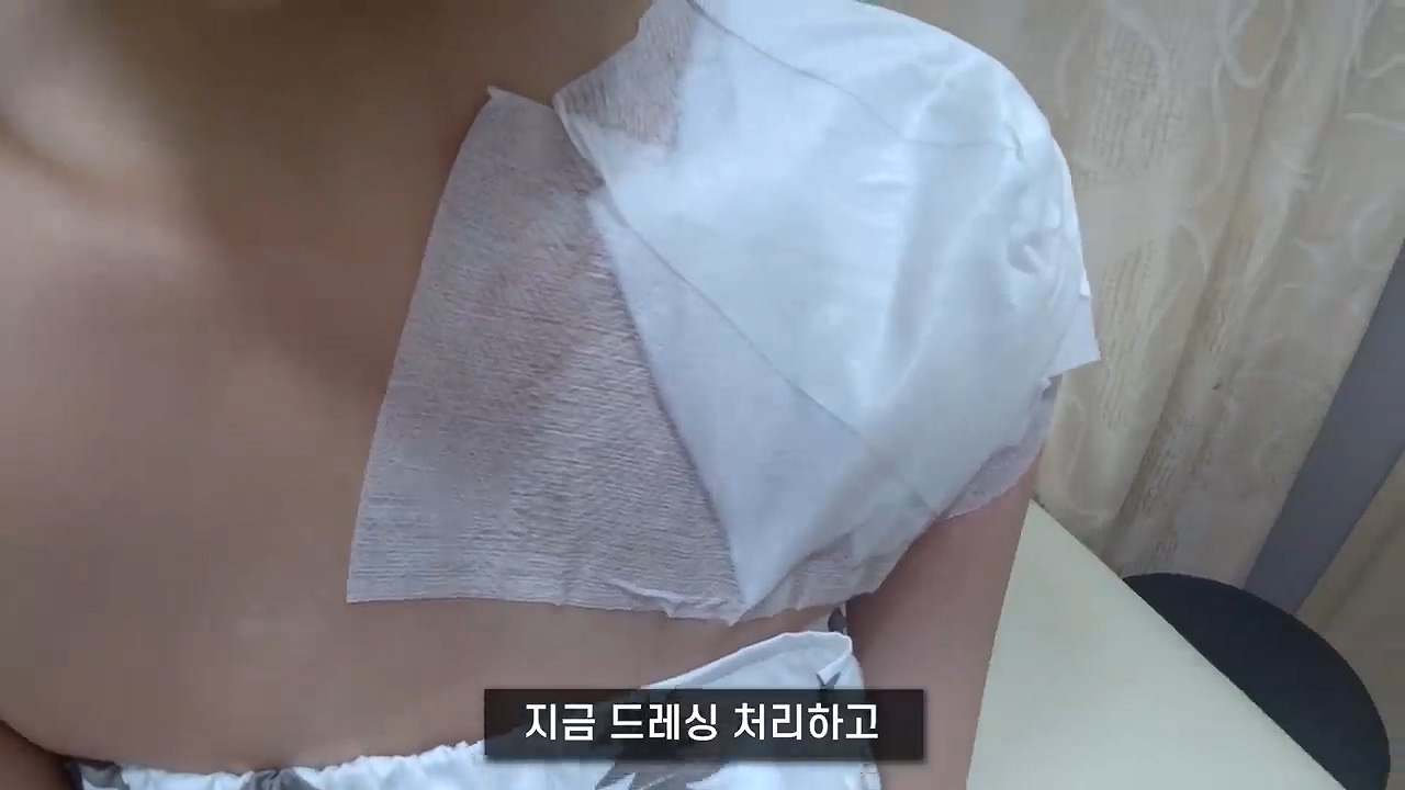 문신 제거 후기 - 꾸르