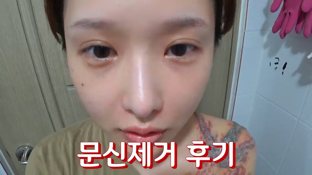 문신 제거 후기 - 꾸르