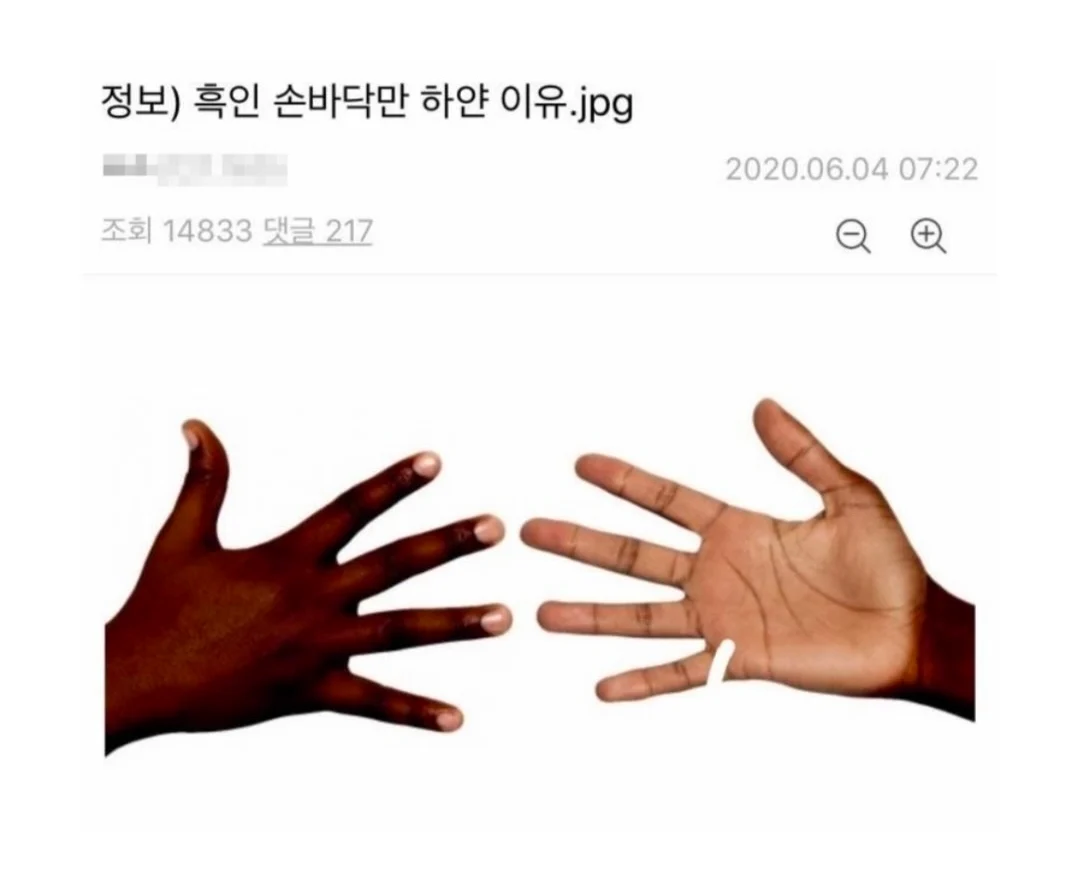 정보) 흑인 손바닥만 하얀 이유